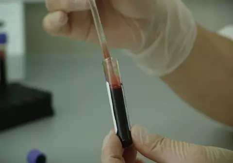 Sângele cazurilor vindecate de coronavirus ar putea fi folosit ca tratament pentru pacienții bolnavi de COVID-19