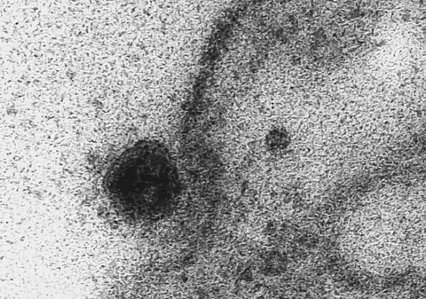 Cum ne atacă coronavirusul.  Momentul în care Sars-CoV-2 infectează o celulă perfect sănătoasă a fost surprins în imagini inedite