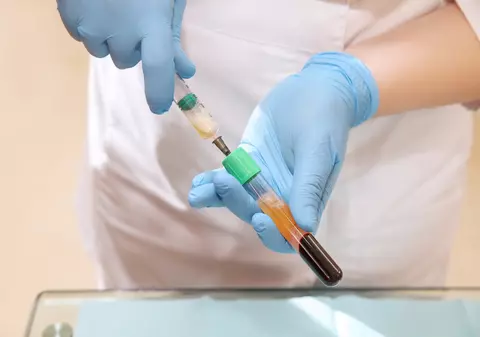 Astăzi se recoltează prima pungă de plasmă convalescentă COVID. Donatorul este un medic din prima linie de la Babeș