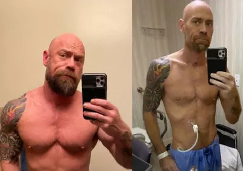 Transformarea şocantă a unui pacient COVID-19 după ce a stat şase săptămâni în spital