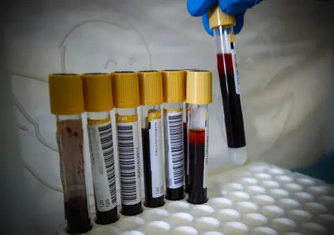 A explodat numărul de cazuri de coronavirus în Republica Moldova. Autoritățile iau măsuri dure: Cimitirele din Chișinău rămân închise de Paștele Blajinilor