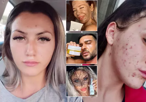 „Fața mea a început să se descompună”. Un fals dermatolog e acuzat că a vândut produse toxice pentru ten, promovate de vedete precum Dorian Popa și Gina Pistol. Mai multe victime au făcut plângere