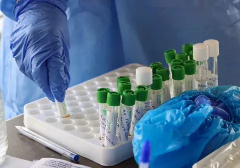 HBO va produce un serial despre cursa mondială pentru obţinerea unui vaccin anti-COVID-19