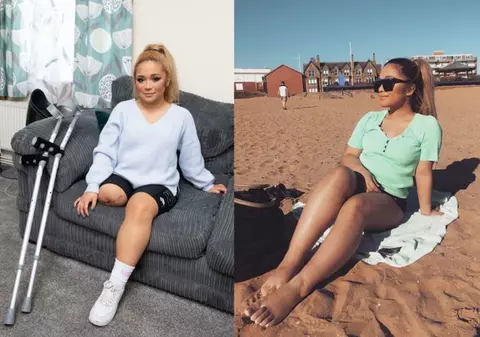 O asistentă care a ignorat durerea pentru a îngriji bolnavii de COVID-19 a rămas fără un picior. ”Totul vine cu un cost”