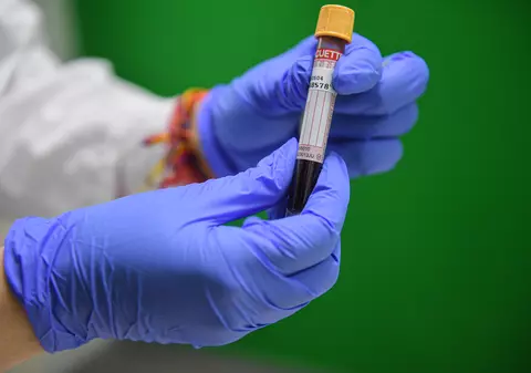 Întrebarea la care toată lumea vrea un răspuns: Cât timp suntem imuni după ce ne-am vindecat de COVID-19?