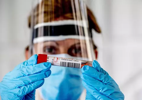 Noi teste pentru un vaccin anti-Covid-19 pe bază de anticorpi de la cai