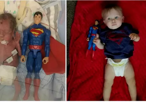 Povestea băieţelului care la naştere era cât o figurină Superman. Medicii nu i-au dat șanse de supraviețuire