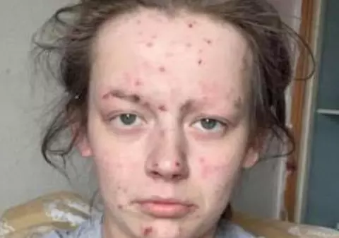 Transformarea uluitoare a unei mame care a fost dependentă de heroină și cocaină. Cum arată femeia după patru luni în care nu a mai consumat droguri