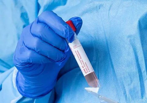 Intrarea pe teritoriul Irlandei se va face cu un test negativ la COVID-19