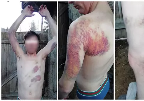 Tânăr dintr-o comună din Bacău bătut crunt după ce ar fi furat o pătură de fân. Vecinii îl acuză pe șeful de post din sat, IPJ a sesizat Parchetul