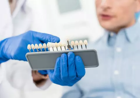 (Publicitate) Cum se alege implantul dentar și ce factori influențează decizia?