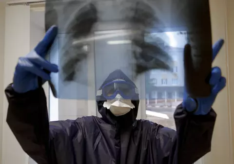 Premieră mondială: Transplant la plămâni pentru un pacient grav afectat de Covid-19 de la donatori în viață