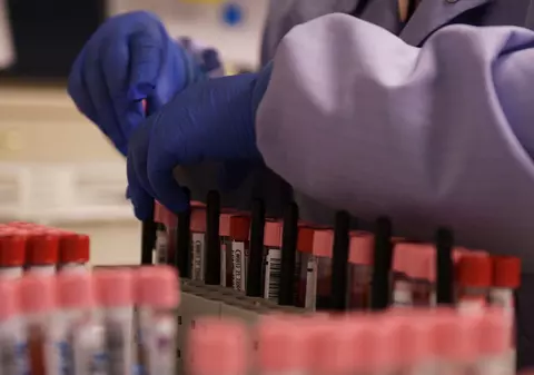 Ministerul Sănătății, explicații despre anticorpii anti-COVID-19. „Sunt prezenţi în organism la 6 şi chiar 8 luni de la infectare”