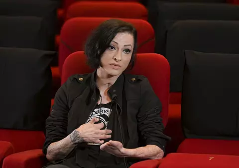 „Mi-am văzut pielea de pe mâini cum curgea, ca o mănușă întoarsă pe dos”. Mărturie la BBC a unei supraviețuitoare Colectiv