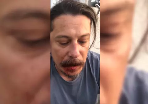 Jurnalistul turc Erk Acarer, critic al regimului Erdogan, atacat cu cuțitul în propria casă, în Berlin. Cum se simte