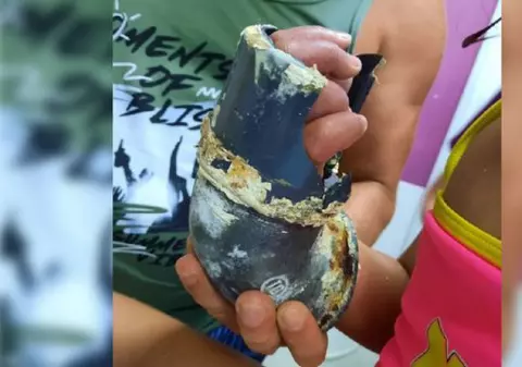 O fetiță de 5 ani, la spital, după ce și-a prins mâna în scurgerea unei piscine din Mamaia