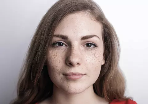 Ten cu pistrui: 5 sfaturi de îngrijire