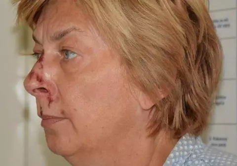 O femeie găsită într-o zonă pustie din Croația nu își amintește cum a ajuns acolo. Ce au descoperit acum autoritățile