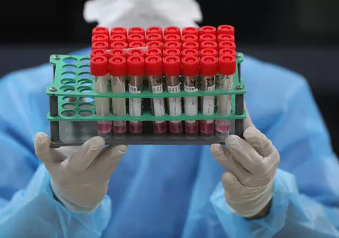 112 noi infectări cu Omicron, confirmate în România. Numărul total al cazurilor depistate a ajuns la 295