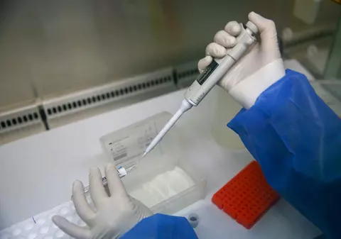 Un virus care afectează 95% dintre adulți e responsabil pentru scleroza multiplă, au descoperit cercetătorii americani