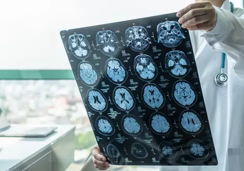 Mai mulți tineri dintr-o provincie canadiană, afectați de o boală neurologică misterioasă. Medicii nu știu ce o declanșează