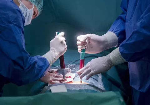 Un nou transplant de celule stem pare să fi vindecat de HIV o a treia persoană în lume