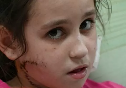 VIDEO | Fetiță de 11 ani împușcată în față de soldații ruși, care apoi i-au acordat primul ajutor și au trimis-o la spital, lângă Mariupol