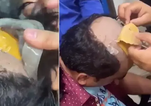 Aur de 40.000 de dolari lipit de cap, sub perucă, de un contrabandist indian chel