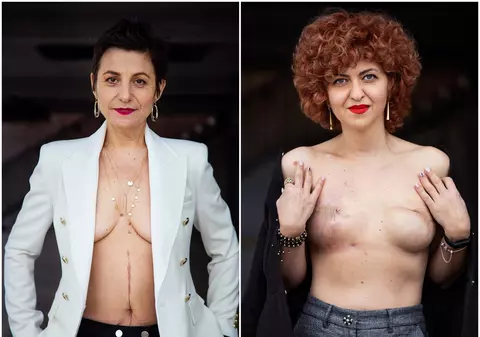 Lupta, supraviețuirea și schimbarea provocate de un diagnostic de cancer. Două femei povestesc cum au învins boala