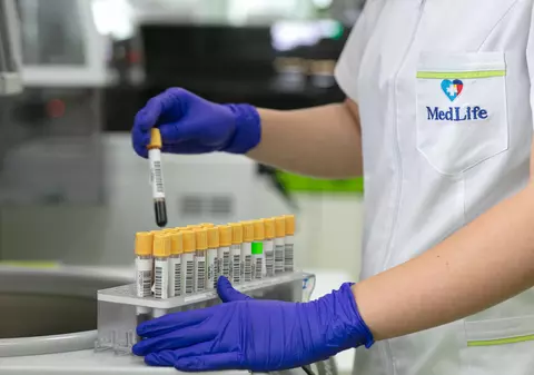 De ce e important să-ți faci anual analize și cum te pot ajuta în acest sens abonamentele medicale private