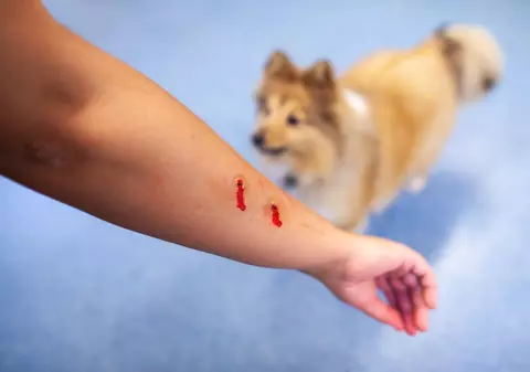 Primul ajutor în cazul unei mușcături de câine