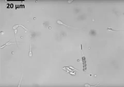 Omenirea s-ar putea confrunta cu o criză a reproducerii, din cauza scăderii numărului de spermatozoizi - studiu