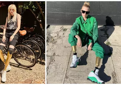 Povestea incredibilă a modelului care a rămas fără picioare din cauza unui tampon. A sfidat toate piedicile puse de soartă