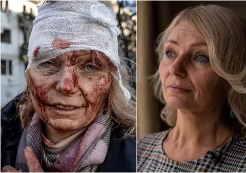 EXCLUSIV la un an de război. Femeia-simbol, rănită într-un bloc de locuințe în primul bombardament rusesc, interviu pentru români: „Încă mă tratez. Visez bombe, rachete, explozii”