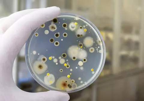 Cele mai periculoase bacterii care pot contamina alimentele