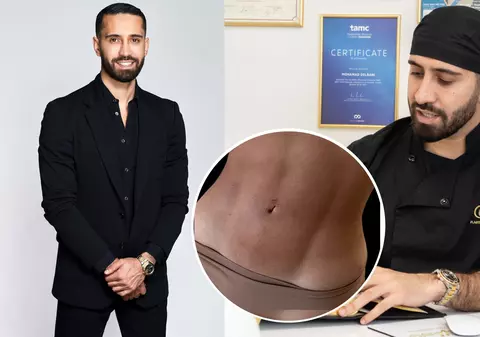 Sfaturi esențiale de la Dr. Delbani pentru recuperarea rapidă după intervenția de liposucție abdominală Vaser HD