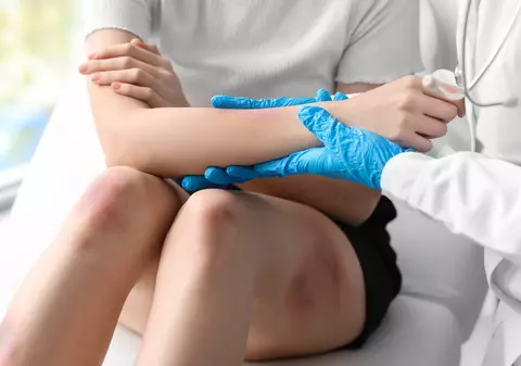 Care este diferenţa dintre echimoză şi hematom