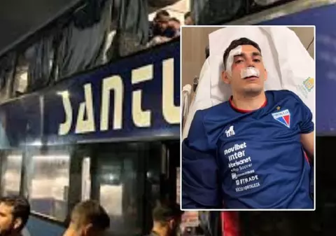 Șase fotbaliști au fost răniți în Brazilia după ce autocarul le-a fost atacat cu pietre și „dispozitive explozive” de fanii unei echipe adverse