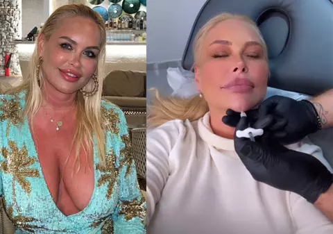 Vica Blochina, patru intervenții estetice într-o săptămână pentru a arăta cu 10 ani mai tânără. Câți bani a scos din buzunar pentru proceduri