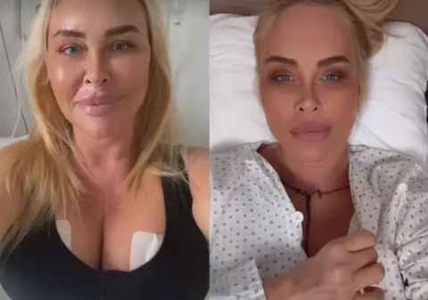 Vica Blochina, 6 ore pe masa de operație. Ce intervenții estetice și-a făcut: „Va fi nevoită să poarte un corset timp de aproximativ 8 săptămâni”