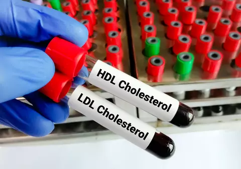 Alimente care ajută la scăderea colesterolului