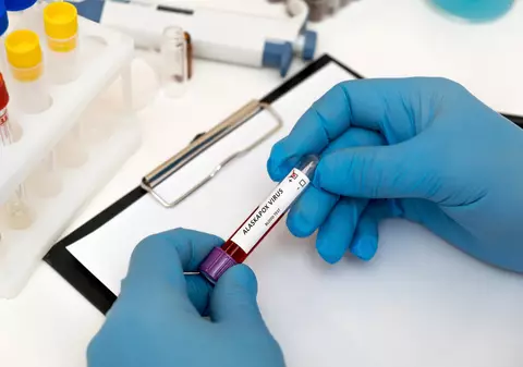 Ce este virusul Alaskapox?