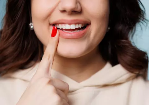 3 tipuri de fațete dentare și când sunt recomandate