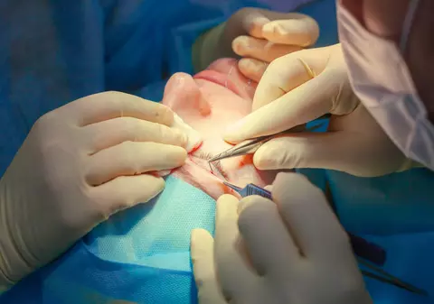 Chirurgia estetică, noua salvare pentru fugari și infractori. Țara asiatică unde spitale clandestine oferă servicii de „creare a unei persoane complet noi”