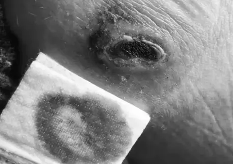 Ce a pățit o tânără din Elveția care a adormit pe încărcătorul de telefon băgat în priză: „Îmi voi face un tatuaj”. Imagini care vă pot afecta emoțional