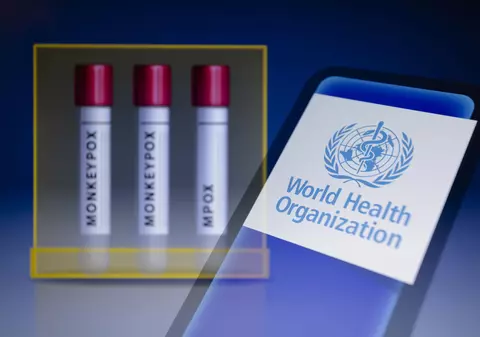 Suedia a confirmat primul caz de variola maimuței, forma cea mai gravă, din afara Africii