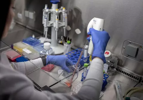 Descoperire revoluționară făcută de oamenii de știință. Proteina BCL-2 poate fi „cheia” în tratamentul pentru cancerul de prostată