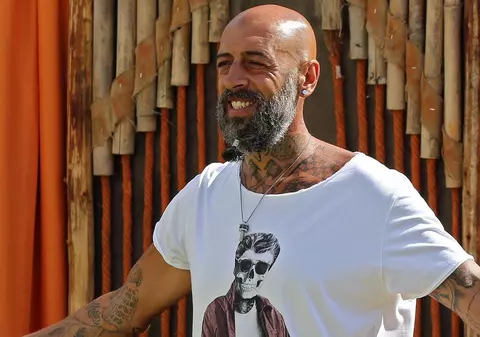 CRBL își face prima intervenție estetică. De ce a luat această decizie. „Se pare că, odată cu trecerea timpului, se agravează”