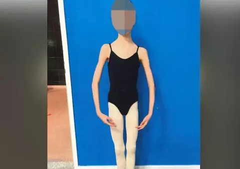 Doi părinți și-au înfometat fiica pentru că doreau să rămână mică. Fata de 17 ani ajunsese să cântărească 27,3 kilograme