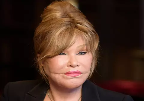 Jocelyn „Catwoman” Wildenstein a murit. Cea mai cunoscută victimă a chirurgiei plastice avea 84 de ani